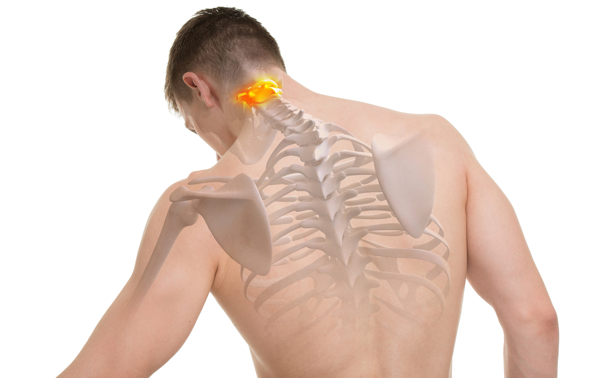 Durch verspannungen im nacken herzstolpern Nackenschmerzen durch